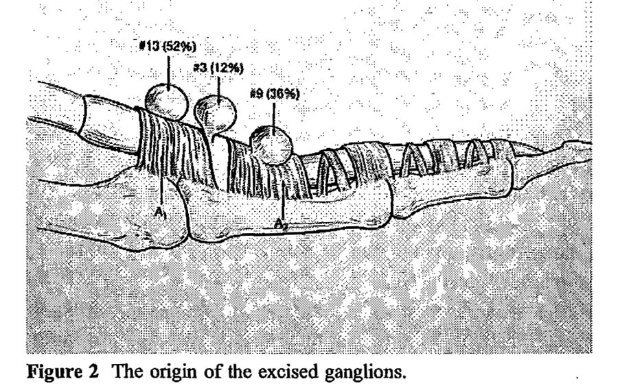 ganglions.jpg